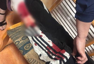 Очередное нападение: в Татарстане бродячая собака разорвала ногу ребенку 05/06/2026 &ndash; Новости